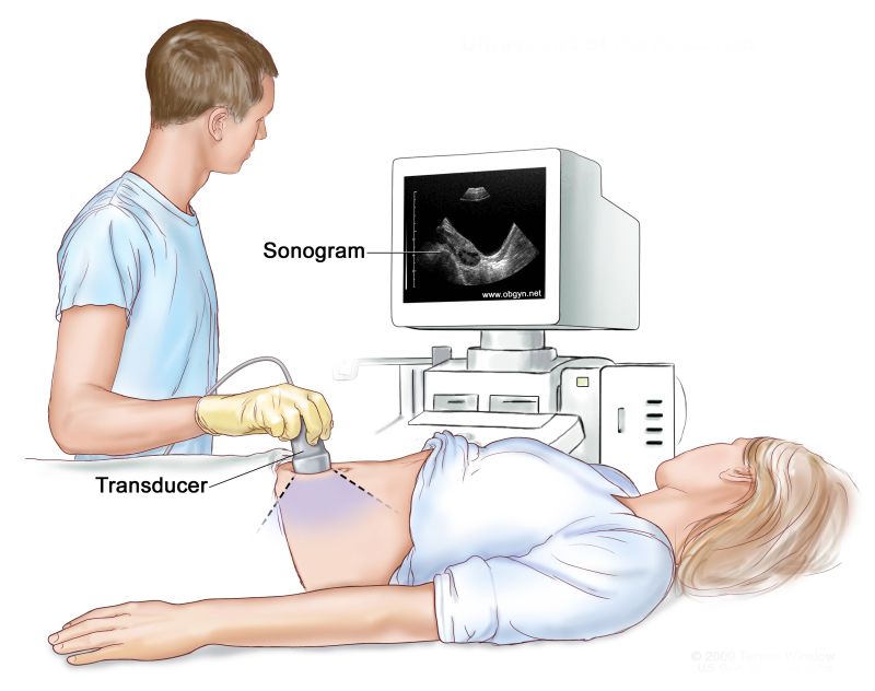 Abdominal ultrasound