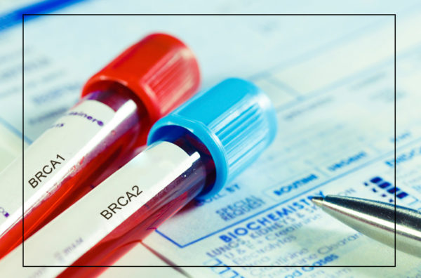 BRCA TESTING/FAMILIAL OVARIAN CANCER